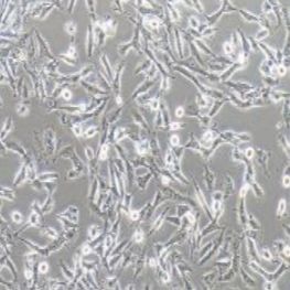 U251MG/TMZ人类星形胶质瘤耐替莫唑胺细胞