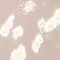 ZR-75-1人乳腺癌细胞(提供STR鉴定报告)