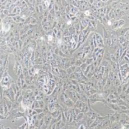 T98G人胶质母细胞瘤(提供STR鉴定报告)