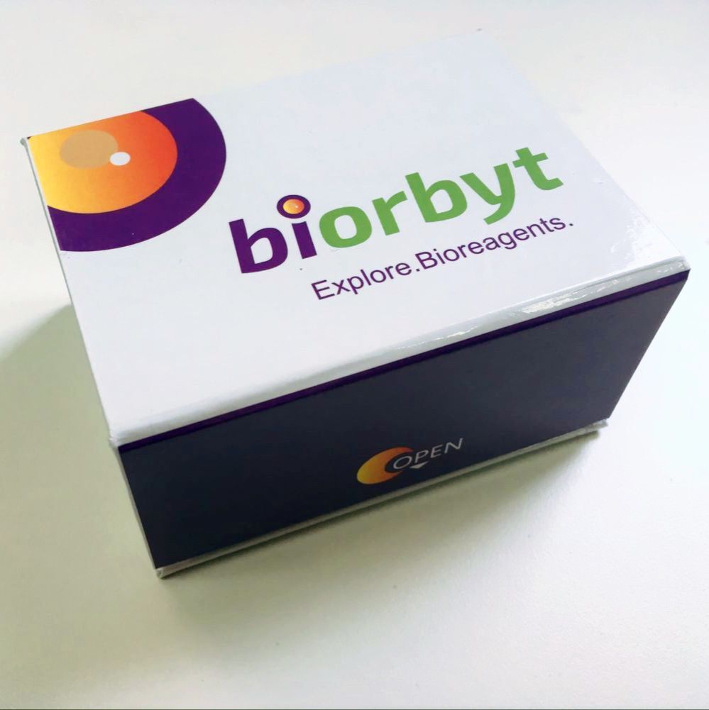 Mouse LBP ELISA Kit 酶联免疫试剂盒，orb1199924，biorbyt