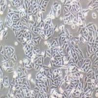 SW480人结肠腺癌细胞(提供STR鉴定报告)