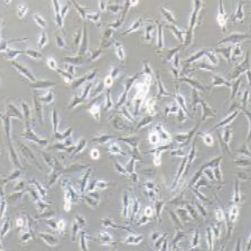 U251MG人类星型胶质细胞瘤(提供STR鉴定报告)