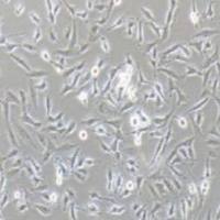 U251MG人类星型胶质细胞瘤(提供STR鉴定报告)