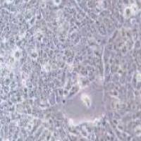 TE-12人食管癌细胞(提供STR鉴定报告)