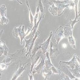 SW579人甲状腺癌细胞(提供STR鉴定报告)