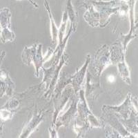 SW579人甲状腺癌细胞(提供STR鉴定报告)