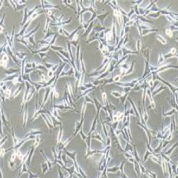 WM-115人恶性黑色素瘤细胞(提供STR鉴定报告)