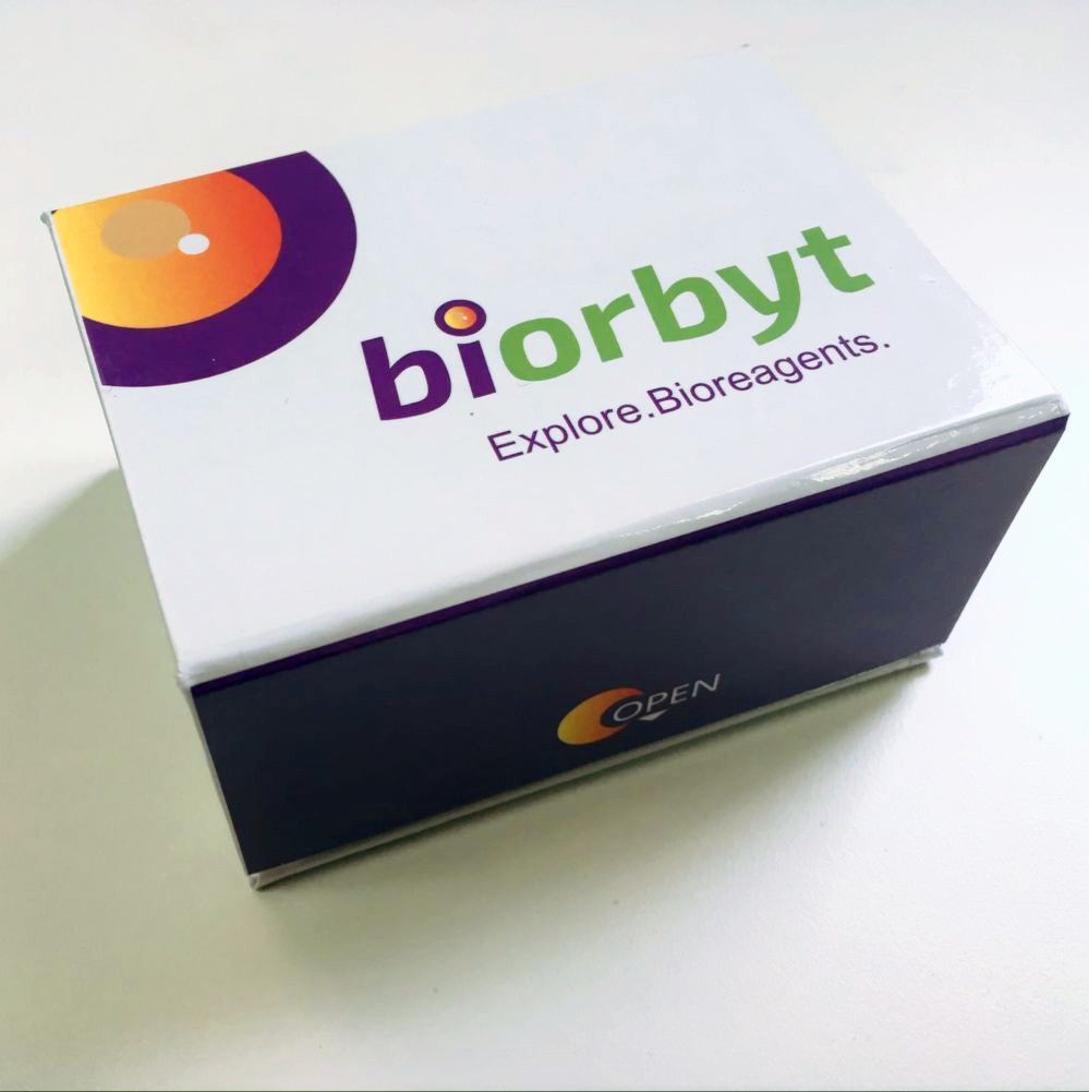 Human Inhibin Beta B (INHbB) ELISA Kit 酶联免疫试剂盒，orb1207003，biorbyt