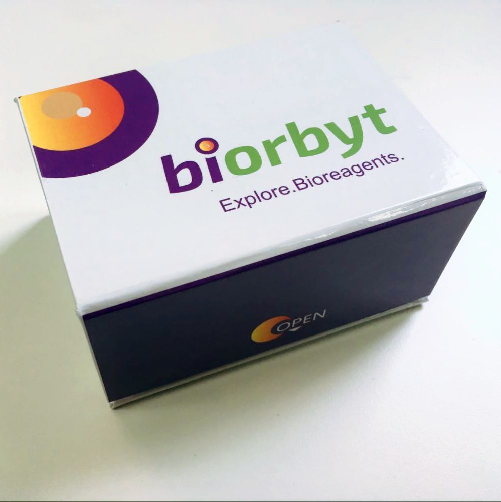Human TG ELISA Kit 酶联免疫试剂盒，orb776217，biorbyt