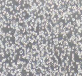 U266人骨髓瘤细胞(提供STR鉴定报告)