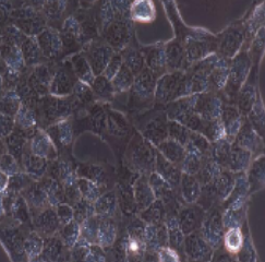 TPC-1人乳头状甲状腺癌细胞(提供STR鉴定报告)