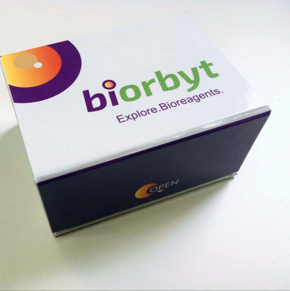 Human Neurotrimin ELISA Kit 酶联免疫试剂盒，orb1209604，biorbyt
