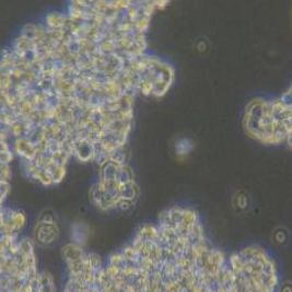 Y79人视网膜母细胞瘤细胞(提供STR鉴定报告)