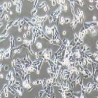 UM-UC-3人膀胱移行细胞癌(提供STR鉴定报告)