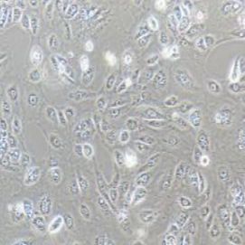 SNU-182人肝癌细胞(提供STR鉴定报告)