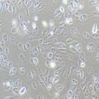 SNU-182人肝癌细胞(提供STR鉴定报告)