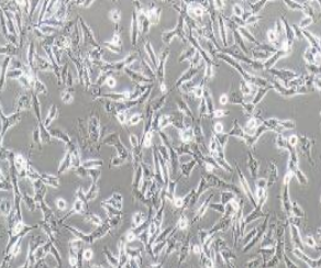 U251MG/TMZ+luc人类星形胶质瘤耐替莫唑胺细胞