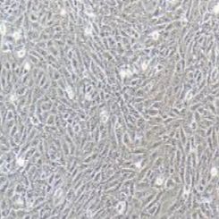 SV40-MES-13小鼠肾小球系膜细胞（提供种属鉴定）