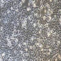 GL261+luc小鼠胶质细胞瘤+luc