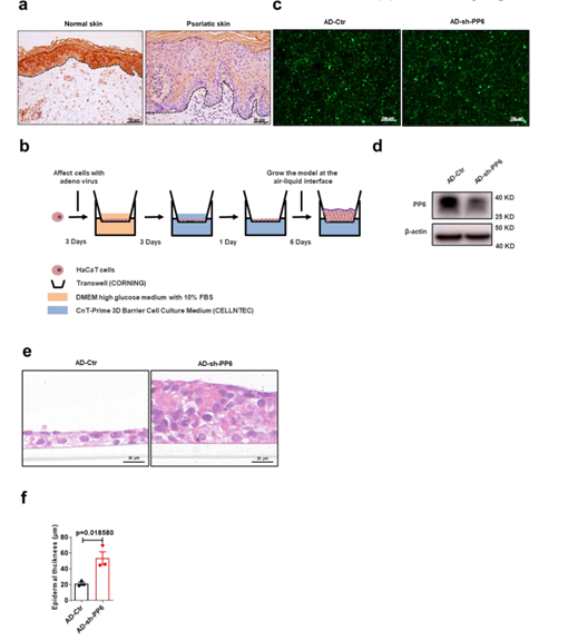 NAT COMMUN：银屑病治疗药物作用机制新发现