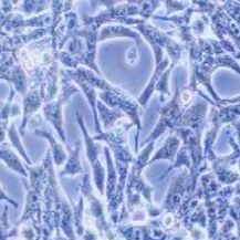 PANC02小鼠胰腺癌细胞（提供种属鉴定）