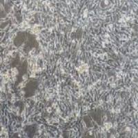 4T1+luc小鼠乳腺癌细胞+luc