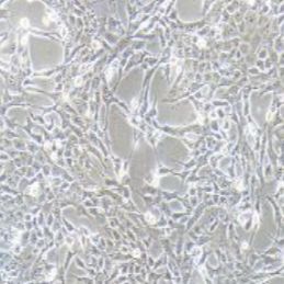 4T1小鼠乳腺癌细胞（提供种属鉴定）