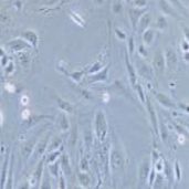 MS1小鼠胰岛内皮细胞（提供种属鉴定）