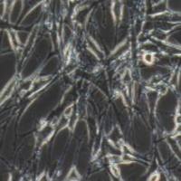 OP9小鼠骨髓基质细胞（提供种属鉴定）