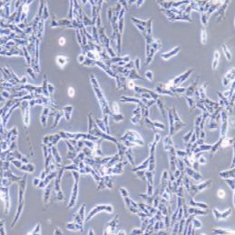 CTX-TNA2大鼠脑I型星形胶质细胞（提供种属鉴定）