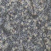 LLC+luc小鼠肺癌细胞荧光素酶标记