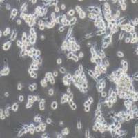 U14小鼠子宫颈癌细胞（提供种属鉴定）