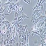 RENCA小鼠肾癌细胞（提供种属鉴定）