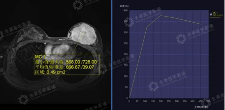 不痛不痒，它在悄悄恶变