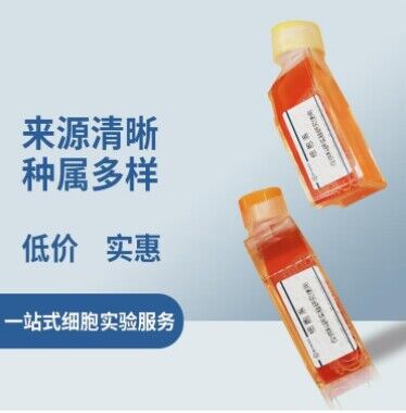 FaDu人咽鳞癌细胞 (STR鉴定正确)