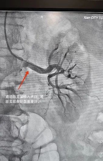 看似小问题 实则大隐患——西安市中医医院心血管疾病科普三则