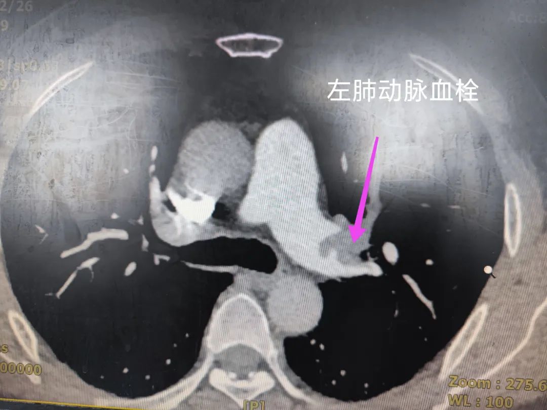 看似小问题 实则大隐患——西安市中医医院心血管疾病科普三则