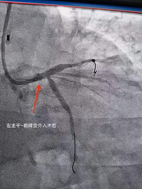 看似小问题 实则大隐患——西安市中医医院心血管疾病科普三则