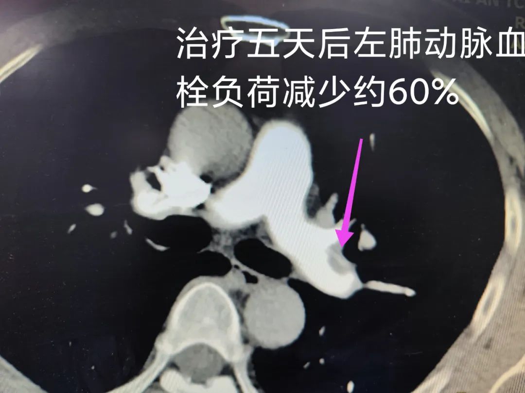 看似小问题 实则大隐患——西安市中医医院心血管疾病科普三则