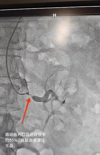 看似小问题 实则大隐患——西安市中医医院心血管疾病科普三则
