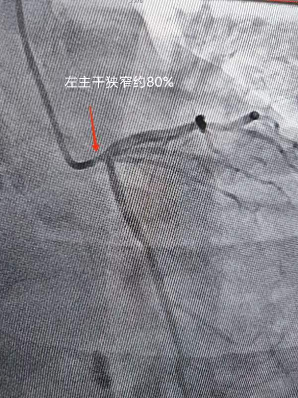 看似小问题 实则大隐患——西安市中医医院心血管疾病科普三则