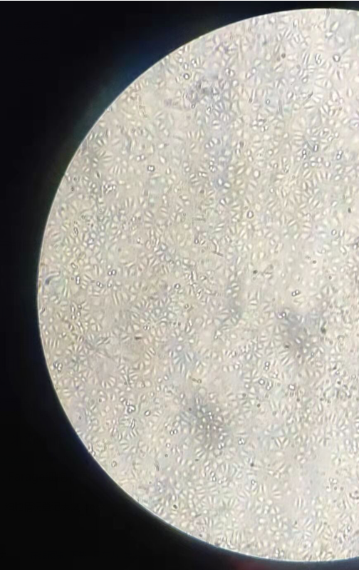 细胞世界:细胞培养时候里面的圆球球到底是什么？