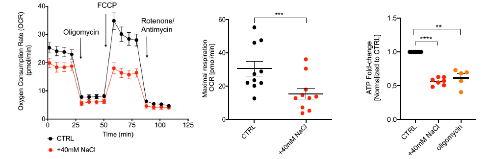 为啥免疫力总比别人差?《Cell》子刊发现与饮食有关