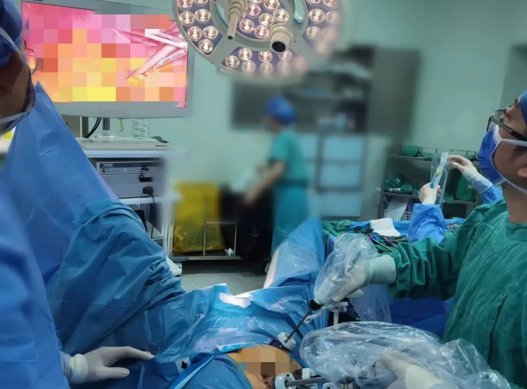 全结肠切除和永久性回肠造口术 - 外科手术学 - 天山医学院