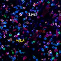 TSA免疫荧光五标六色实验