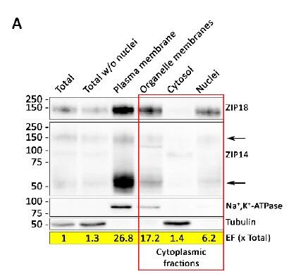 如何用WB鉴定膜蛋白提取是否成功?