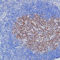 Bcl-6 Recombinant Rabbit mAb