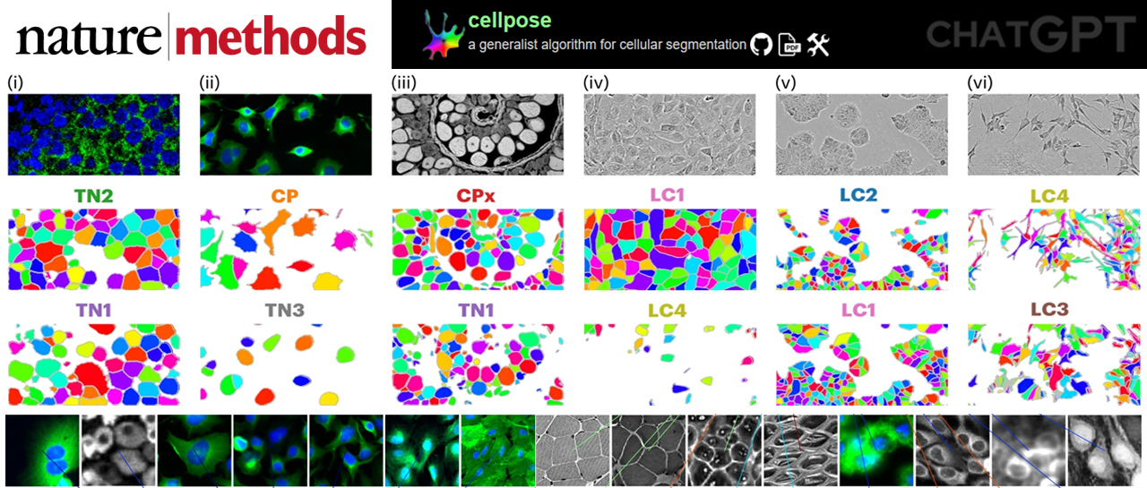 科技前沿 | "AI的狂飙" Cellpose: 细胞分割领域的ChatGPT