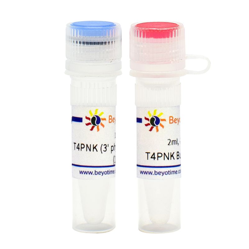 T4 Polynucleotide Kinase (3' phosphatase minus)