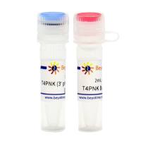 T4 Polynucleotide Kinase (3' phosphatase minus)